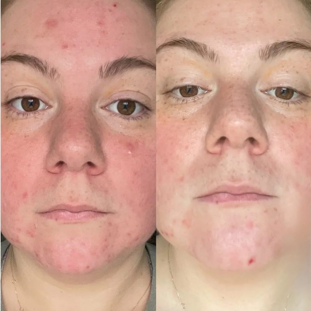 Byroe Celery AHA + LHA Serum - Picture 3 of 7